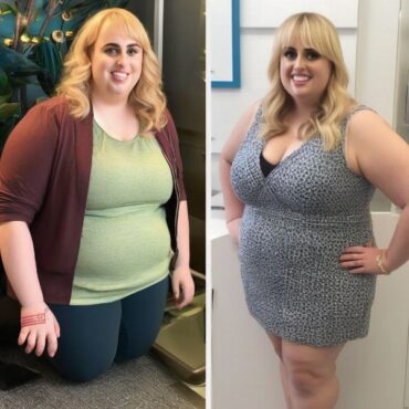 Rebel Wilson Before & After